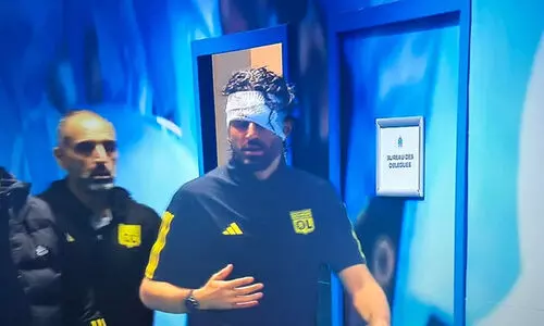 ടീം ബസിനുനേരെ ആക്രമണം; ലിയോൺ പരിശീലകന് പരിക്ക്