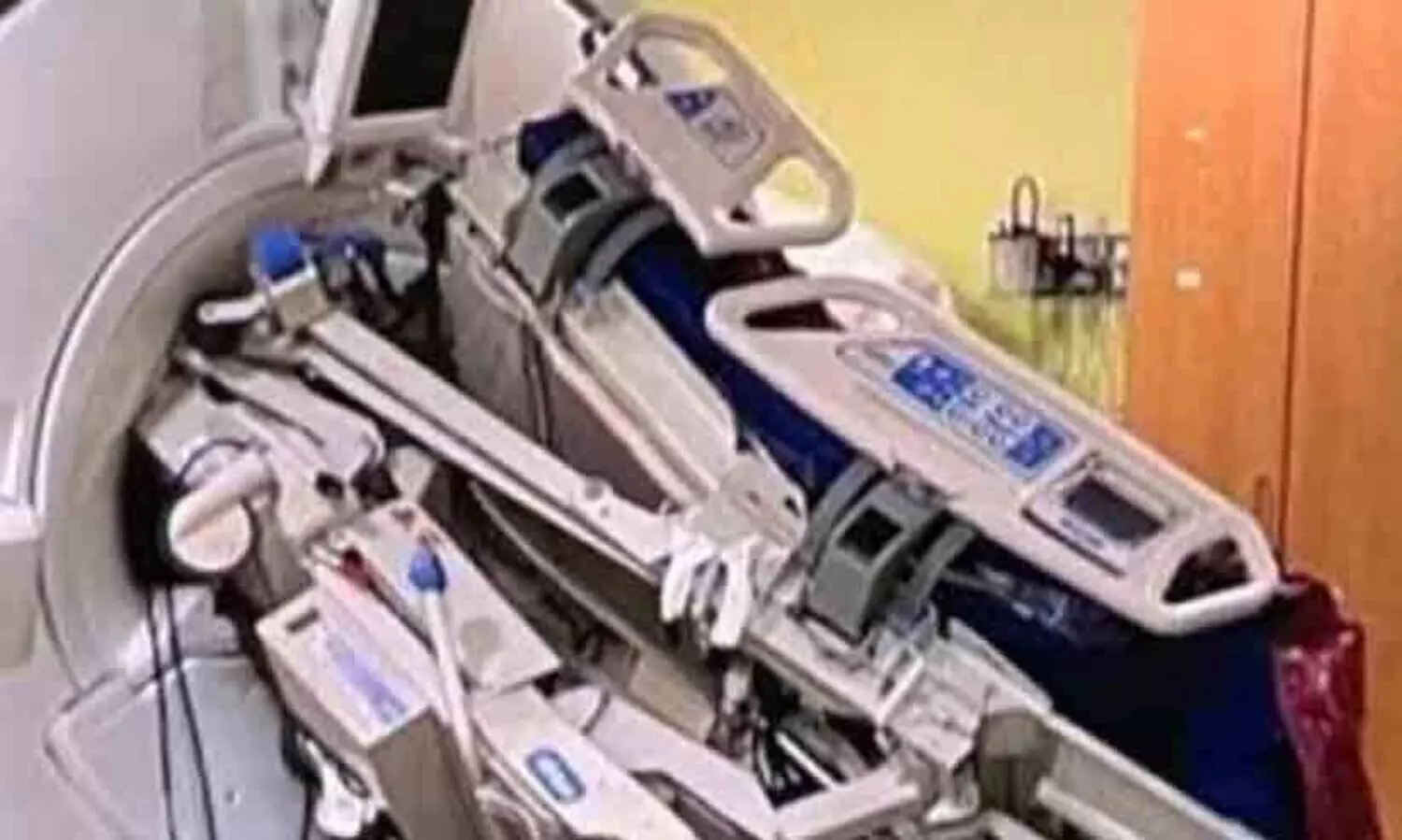 എം.ആർ.ഐ മെഷീനിൽ നഴ്സ് കുടുങ്ങി; ശരീരത്തിൽ സ്ക്രൂ തുളച്ചു കയറി