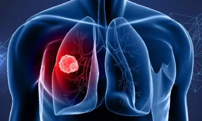 വിവിധ തരം അർബുദങ്ങൾ, ലക്ഷണങ്ങൾ...