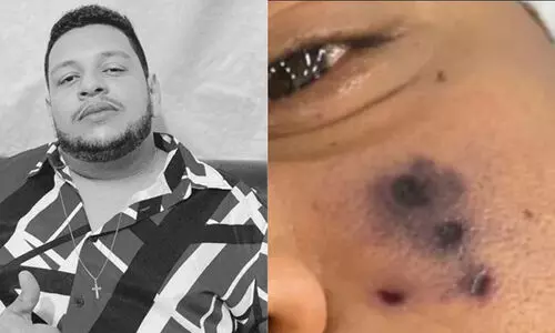 ഗായകൻ ഡാർലിൻ മൊറൈസ് ചിലന്തിയുടെ കടിയേറ്റ് മരിച്ചു