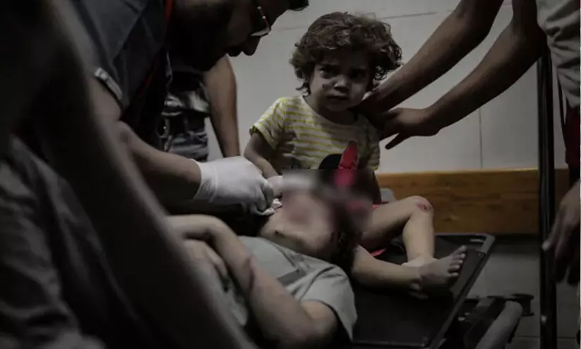 ‘കുഞ്ഞേ, എനിക്ക് കരയാതിരിക്കാനാവുന്നില്ല! നീ അമ്മയേയും അച്ഛനേയും ചോദിക്കല്ലേ...’-തോളെല്ല് പൊട്ടിയ കുട്ടിയെ ചികിത്സിച്ച ഗസ്സയിലെ ഡോക്ടർ പറയുന്നു