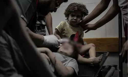 ‘കുഞ്ഞേ, എനിക്ക് കരയാതിരിക്കാനാവുന്നില്ല! നീ അമ്മയേയും അച്ഛനേയും ചോദിക്കല്ലേ...’-തോളെല്ല് പൊട്ടിയ കുട്ടിയെ ചികിത്സിച്ച ഗസ്സയിലെ ഡോക്ടർ പറയുന്നു