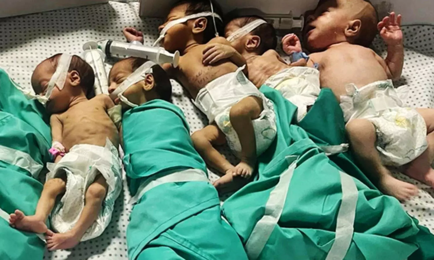 ഇൻകുബേറ്ററിലെ ശിശുക്കളെ കൊന്നൊടുക്കി നാണമില്ലാതെ ഇസ്രായേൽ നുണപ്രചാരണം: പൊളിച്ചടുക്കി ഡോക്ടർമാർ