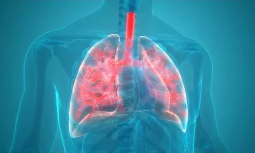 അപകടകാരിയാണ് ന്യൂമോണിയ; കാരണങ്ങൾ, ലക്ഷണങ്ങൾ, രോഗ നിർണയം, ചികിത്സകൾ എല്ലാമറിയാം...