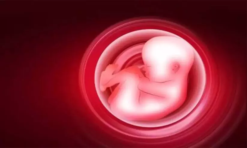 Death of Fetal Child