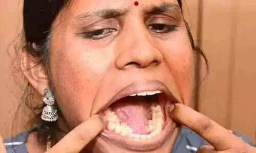 Indian woman, 26, crowned Guinness World Record title for having most teeth