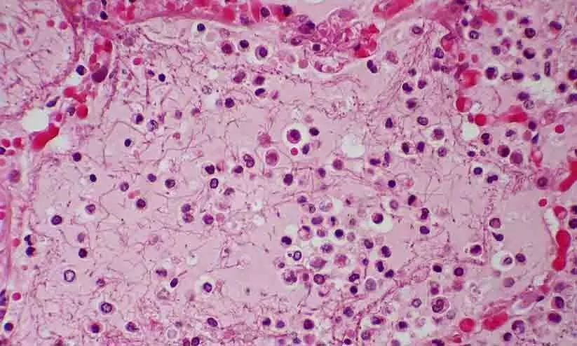 ചൈനയിലെ അജ്ഞാത വൈറസ്: സംസ്ഥാനങ്ങൾക്ക് കേന്ദ്രസർക്കാരിന്റെ ജാഗ്രത നിർദേശം ചൈനയിലെ അജ്ഞാത വൈറസ്: സംസ്ഥാനങ്ങൾക്ക് കേന്ദ്രസർക്കാരിന്റെ ജാഗ്രത നിർദേശം