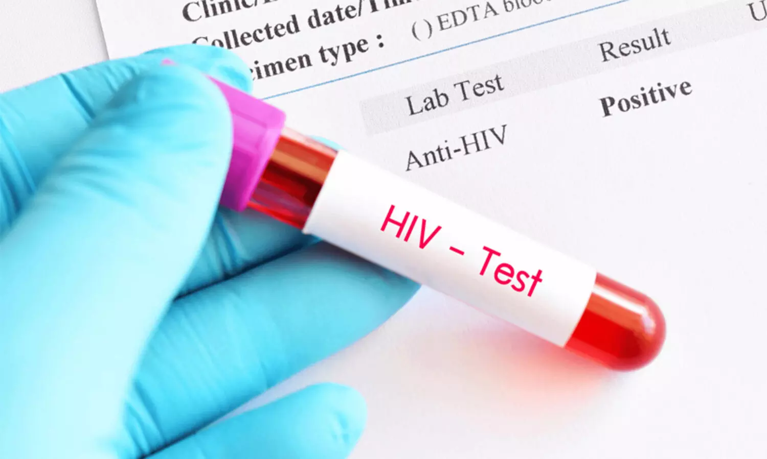 HIV test