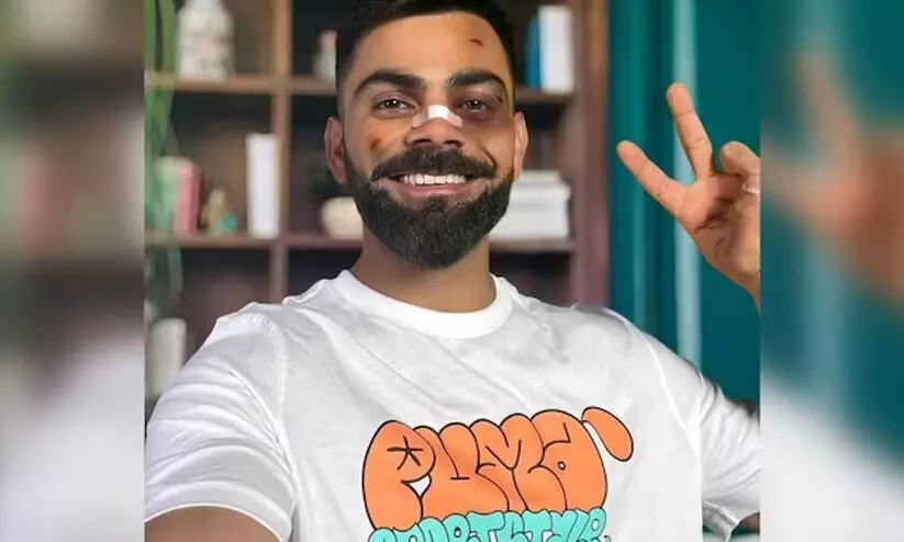 മൂക്കിൽ ബാൻഡേജും കണ്ണിലും മുഖത്തും മുറി പാടുകളുമായി കോഹ്ലി! വൈറൽ ചിത്രത്തിനു പിന്നിലെന്ത്?