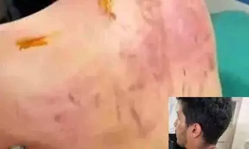 ഹെൽമറ്റ് ധരിക്കാത്ത അഭിഭാഷകനെ മർദിച്ചു; എസ്.ഐക്കും പൊലീസുകാർക്കും സസ്പെൻഷൻ