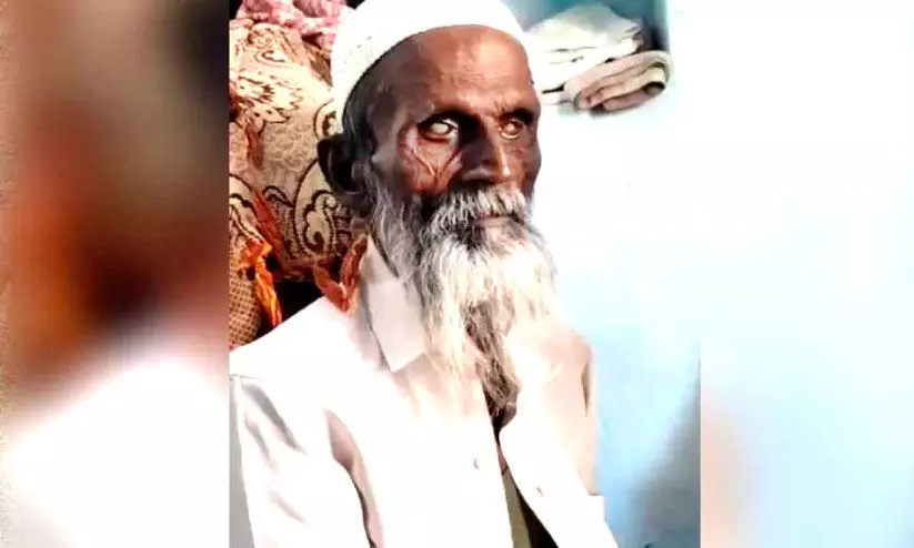 കാഴ്ചപരിമിതിയുള്ള വയോധികനെ മർദിച്ചു; ജയ് ശ്രീറാം വിളിക്കാൻ നിർബന്ധിച്ചു