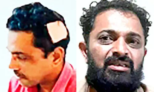 പരാതി അന്വേഷിക്കാനെത്തിയ ​പൊലീസുകാരനെ തലക്കടിച്ചു; പ്രതി അറസ്റ്റിൽ