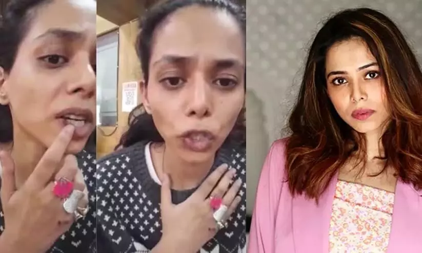 എന്നെ സഹായിക്കണം; മുഖത്ത്  മുറിപ്പാടുകളുമായി നടി -വിഡിയോ