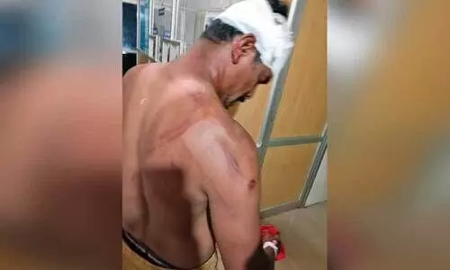 മ​ർ​ദന​ത്തി​ൽ പ​രി​ക്കേ​റ്റ   യൂ​ത്ത് ലീ​ഗ് പ്ര​വ​ർ​ത്ത​ക​ൻ ഷൈ​ജ​ൽ