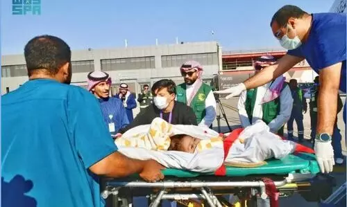 എറിത്രിയൻ സയാമീസ് ഇരട്ടകളെ റിയാദിലെത്തിച്ചു