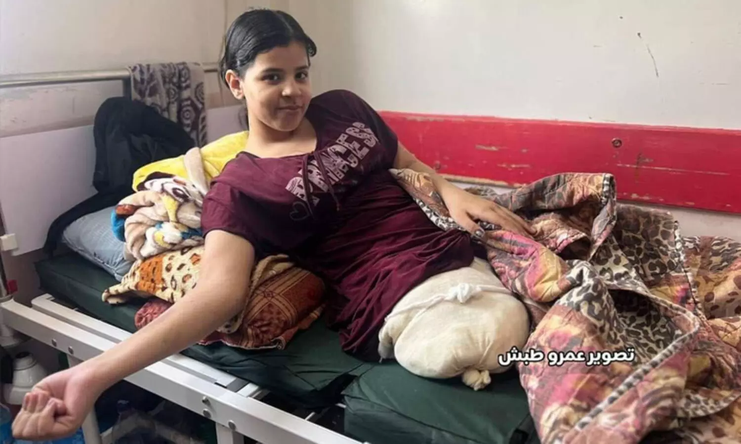 വേദനയായി ദുൻയാ! ആദ്യം അച്ഛനമ്മമാരെ ഇസ്രായേൽ ​കൊന്നു, അവളുടെ കാൽ അറുത്തു, ഇപ്പോൾ ജീവനും...