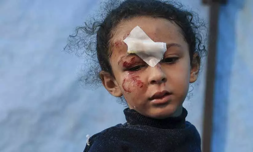 ഇ​സ്രാ​യേ​ൽ ബോം​ബാ​ക്ര​മ​ണ​ത്തി​ൽ പ​രി​ക്കേ​റ്റ ബാ​ലി​ക റ​ഫ​യി​ലെ കു​വൈ​ത്ത് ആ​ശു​പ​ത്രി​യി​ൽ