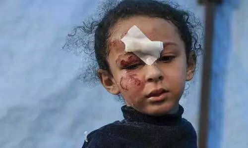 ഇ​സ്രാ​യേ​ൽ ബോം​ബാ​ക്ര​മ​ണ​ത്തി​ൽ പ​രി​ക്കേ​റ്റ ബാ​ലി​ക റ​ഫ​യി​ലെ കു​വൈ​ത്ത് ആ​ശു​പ​ത്രി​യി​ൽ