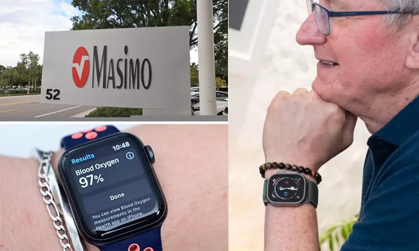 ‘മോഷണം’ വിനയായി; വാച്ചുകൾ വിൽക്കുന്നതിന് ആപ്പിളിന് വിലക്ക്, ഇത് മേസിമോ’യുടെ പ്രതികാരം