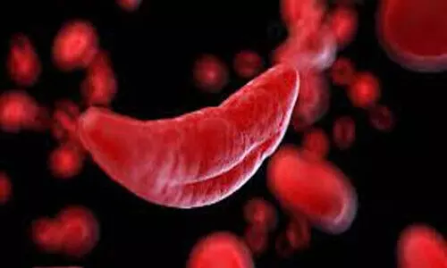 അരിവാൾരോഗം കാർന്നു തിന്നുന്ന അട്ടപ്പാടി