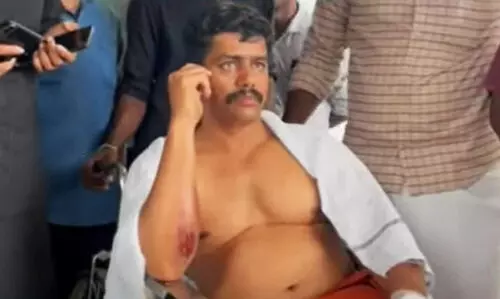 congress worker attacked