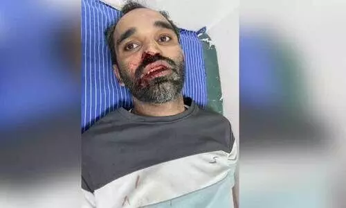 പ​രി​ക്കേ​റ്റ് ചി​കി​ത്സ​യി​ൽ ക​ഴി​യു​ന്ന മു​ഹ​മ്മ​ദ് കു​ഞ്ഞി