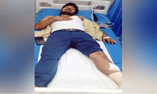 തെരുവുനായ് കുറുകെ ചാടി; ബൈക്ക് നിയന്ത്രണംവിട്ടു മറിഞ്ഞ് യുവാവിന് ഗുരുതര പരിക്ക്