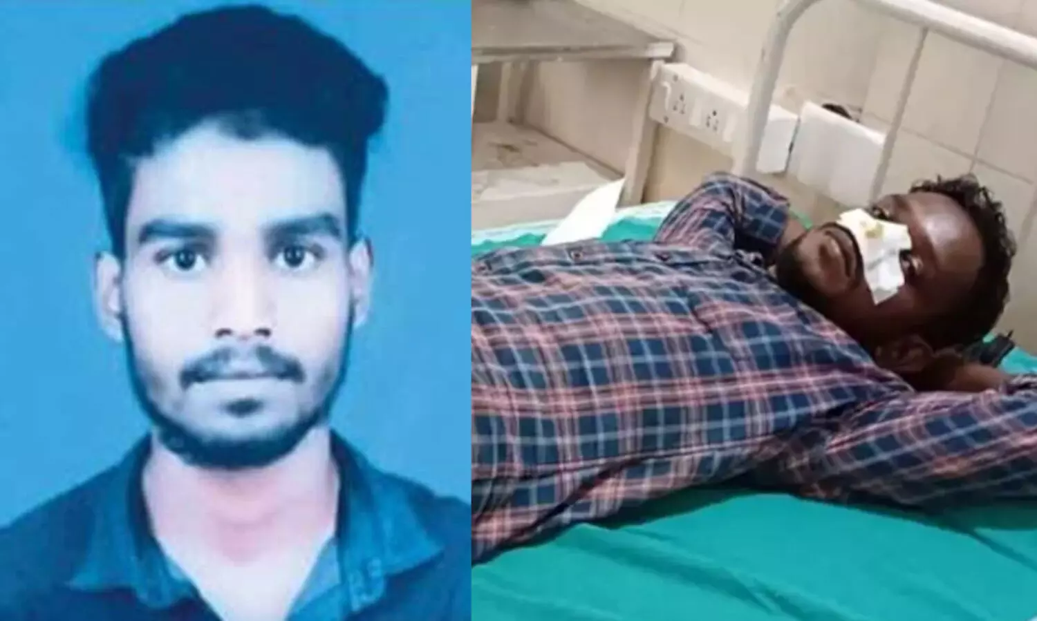 മൂക്കറ്റം മദ്യപിച്ച് സുഹൃത്തിന്റെ മൂക്ക് കടിച്ചു മുറിച്ചു; യുവാവ് അറസ്റ്റിൽ