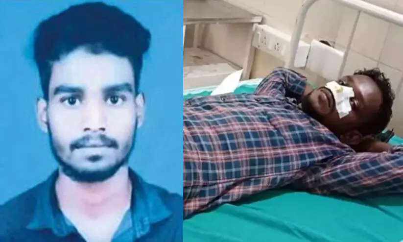 മൂക്കറ്റം മദ്യപിച്ച് സുഹൃത്തിന്റെ മൂക്ക് കടിച്ചു മുറിച്ചു; യുവാവ് അറസ്റ്റിൽ