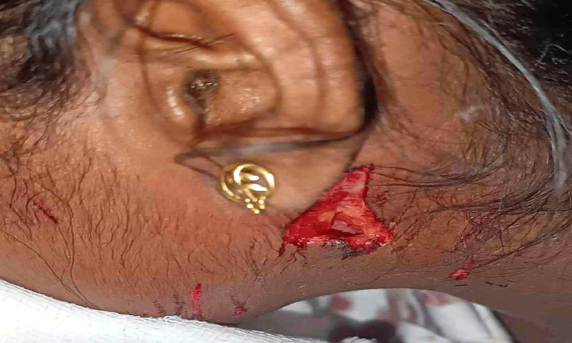 stray dog attack stray dog attack