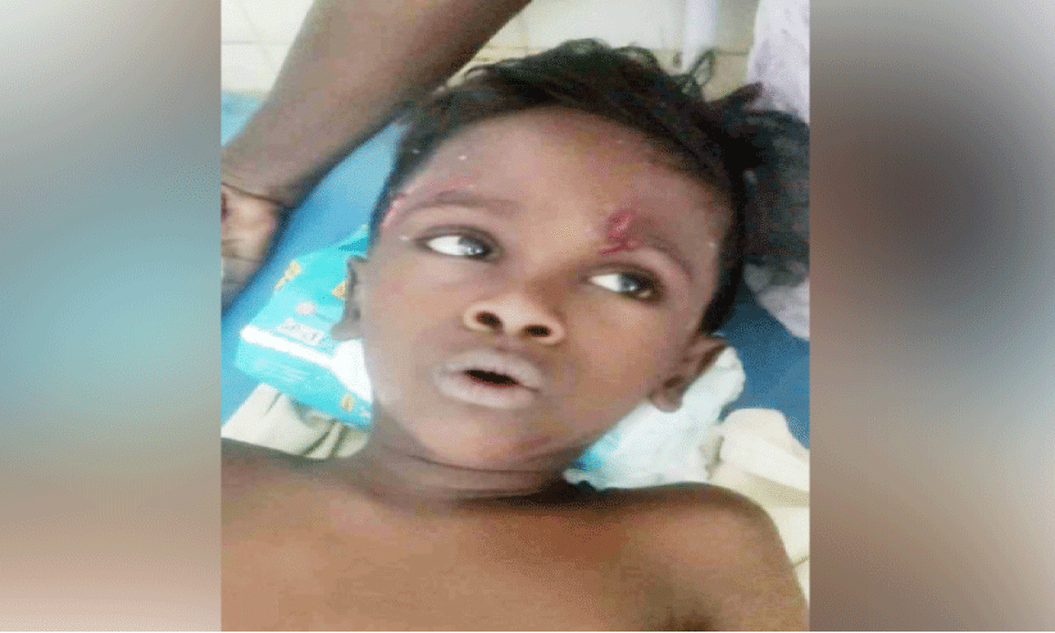 വീടിനകത്ത്​ ഏഴ് വയസ്സുകാരനും വല്യച്ഛനും തെരുവുനായുടെ കടിയേറ്റു