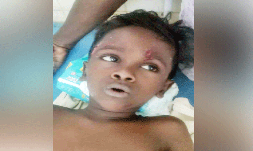 വീടിനകത്ത്​ ഏഴ് വയസ്സുകാരനും വല്യച്ഛനും തെരുവുനായുടെ കടിയേറ്റു