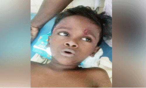 വീടിനകത്ത്​ ഏഴ് വയസ്സുകാരനും വല്യച്ഛനും തെരുവുനായുടെ കടിയേറ്റു