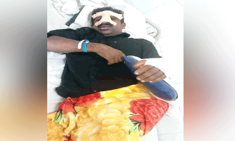 ബൈക്കിൽ കാട്ടുപന്നിയിടിച്ച് ടാപ്പിങ് തൊഴിലാളിക്ക് പരിക്ക് ബൈക്കിൽ കാട്ടുപന്നിയിടിച്ച് ടാപ്പിങ് തൊഴിലാളിക്ക് പരിക്ക്