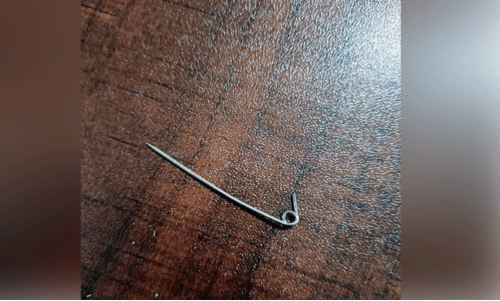 പി​ഞ്ചു​കു​ഞ്ഞി​ന്റെ വ​യ​റ്റി​ൽ​നി​ന്ന് പു​റ​ത്തെ​ടു​ത്ത സേ​ഫ്റ്റി പി​ൻ