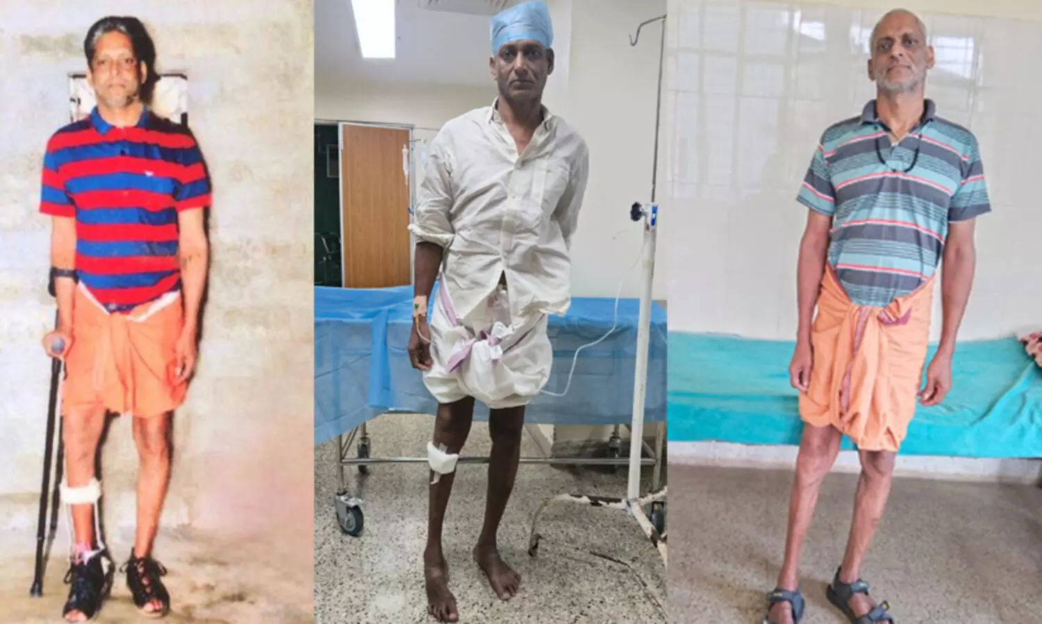 എറണാകുളം സർക്കാർ മെഡിക്കൽ കോളജിൽ അപൂർവ ശസ്ത്രക്രിയ; ഇടുപ്പെല്ല് മാറ്റി സ്ഥാപിച്ചു