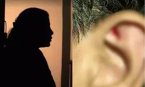 Chennai student undergoes plastic surgery after teacher hits and injures earlobes