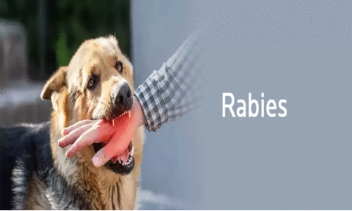 പേവിഷബാധ: ജാഗ്രത പാലിക്കണമെന്ന് തി​രു​വ​ന​ന്ത​പു​രം മെഡിക്കല്‍ ഓഫിസര്‍