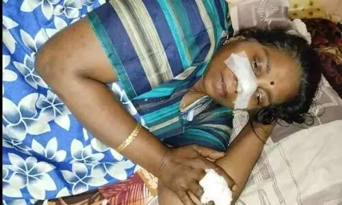 ഭർത്താവിന്റെ വെട്ടേറ്റ് ഭാര്യയുടെ മൂക്ക് അറ്റു തൂങ്ങി; പ്രതി ഒളിവിൽ