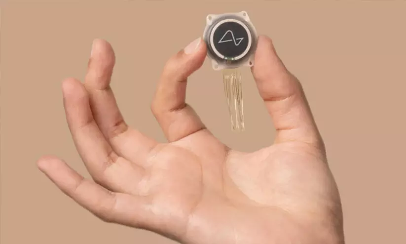 മനുഷ്യന്‍റെ തലച്ചോറിൽ ആദ്യ ചിപ്പ് സ്ഥാപിച്ച് മസ്കിന്‍റെ ന്യൂറാലിങ്ക്