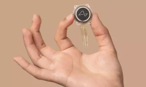 മനുഷ്യന്‍റെ തലച്ചോറിൽ ആദ്യ ചിപ്പ് സ്ഥാപിച്ച് മസ്കിന്‍റെ ന്യൂറാലിങ്ക്