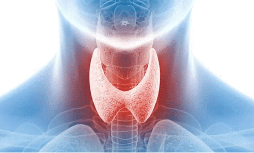 തൈറോയ്ഡ് അപകടകരമാകുമ്പോൾ