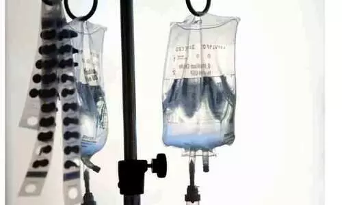 New cancer cases to soar 77 percent by 2050, WHO predicts