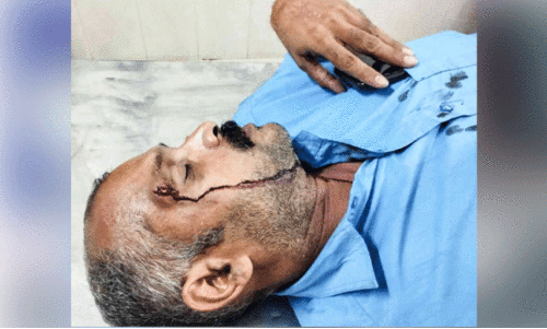 കെ.എസ്.ആർ.ടി.സി ഡ്രൈവറെ  ഡിപ്പോയിൽ കയറി മർദിച്ചെന്ന് പരാതി