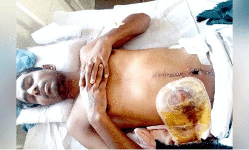 സം​ഘം ചേ​ർ​ന്ന് മ​ർ​ദ​നം; അ​ന്ത​ർ സം​സ്ഥാ​ന തൊ​ഴി​ലാ​ളി​ക്ക് ഗു​രു​ത​ര പ​രി​ക്ക്