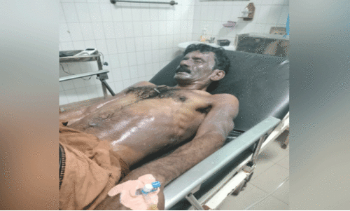 ഗൃഹനാഥന് നേരെ ആസിഡ് ആക്രമണം