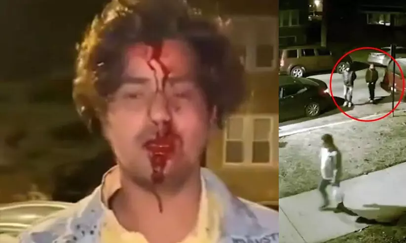 യു.എസിലെ ചിക്കാഗോയിൽ ഇന്ത്യൻ വിദ്യാർഥിക്ക് നേരെ ആക്രമണം