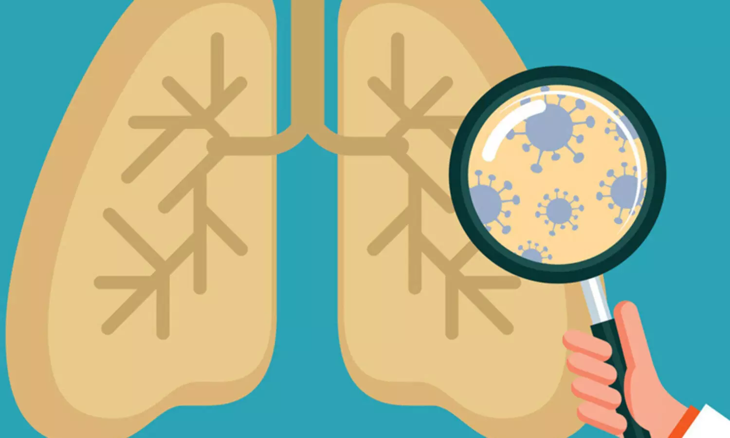 ക്ഷയരോഗ നിവാരണ പ്രവര്‍ത്തനങ്ങള്‍ക്ക് കേരളത്തിന് ദേശീയ പുരസ്‌കാരം