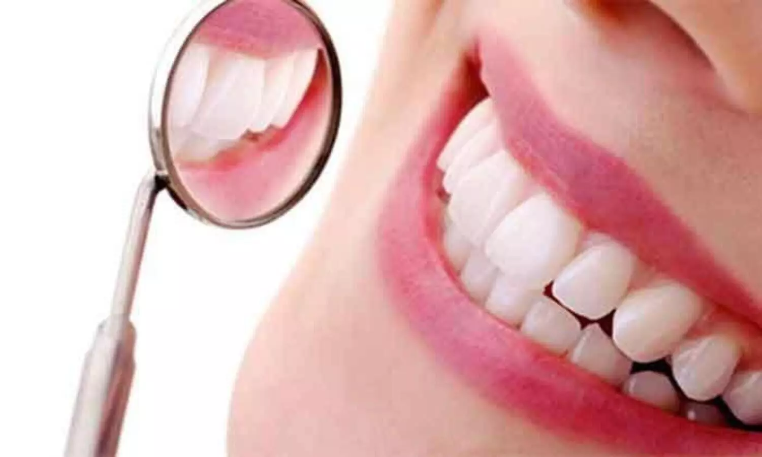 കേടില്ലാത്ത പല്ലിൽ പണിതു; ഡോക്ടർ അഞ്ചുലക്ഷം നഷ്ടപരിഹാരം നൽകണം