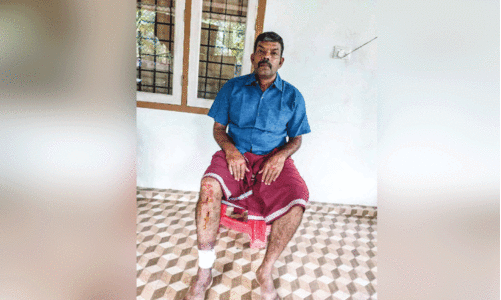 കാട്ടുപന്നിയിടിച്ച് ബൈക്ക് യാത്രക്കാരന് പരിക്ക്